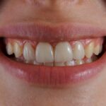 un gros plan de la bouche d'une personne